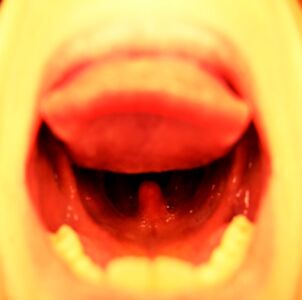 Πέτη Αιγινίτη