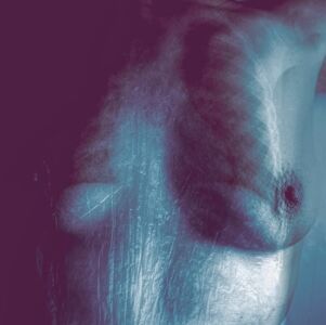 Πέτη Αιγινίτη