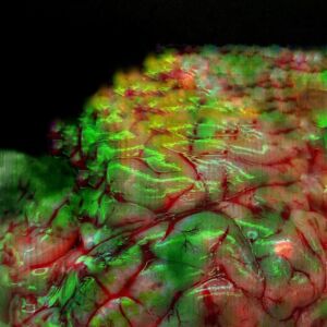 Πέτη Αιγινίτη